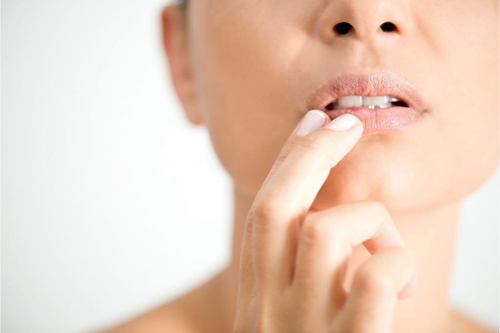 Herpes labial