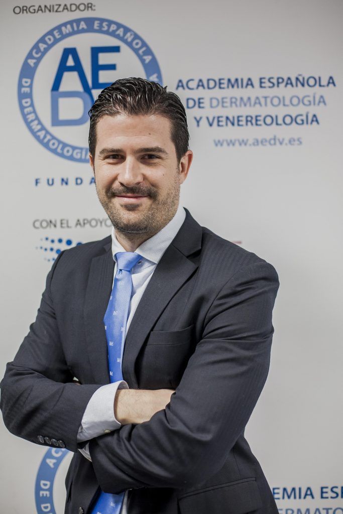 Sergio Vaño. Alopecia androgénica