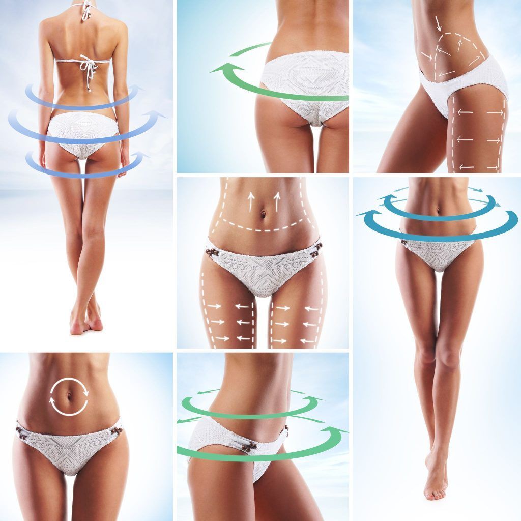 Lipoescultura con ultrasonidos