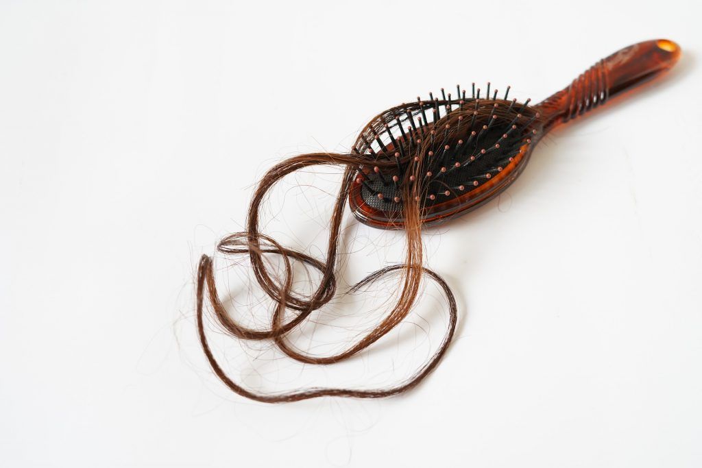 La alopecia femenina