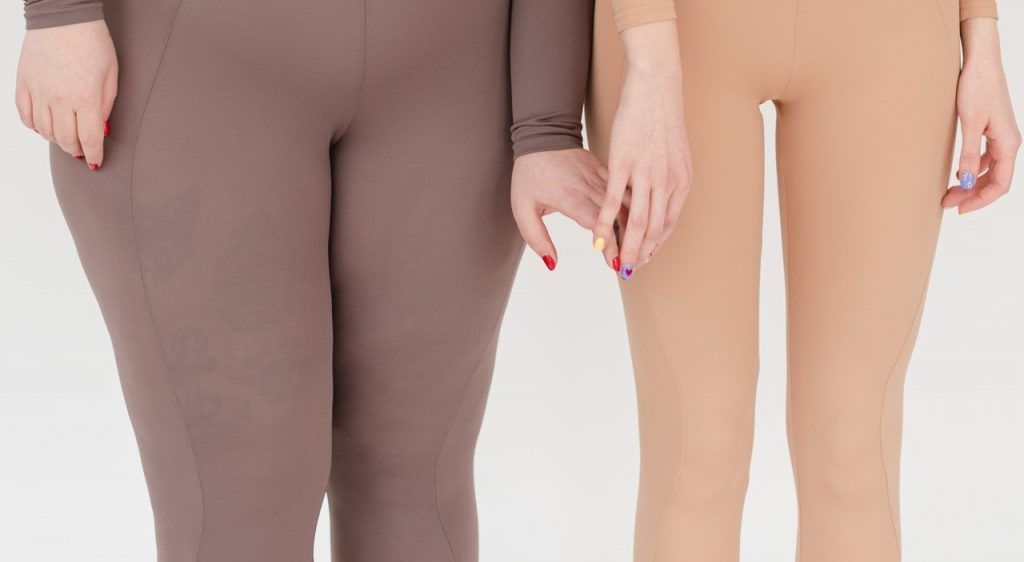 Lipedema