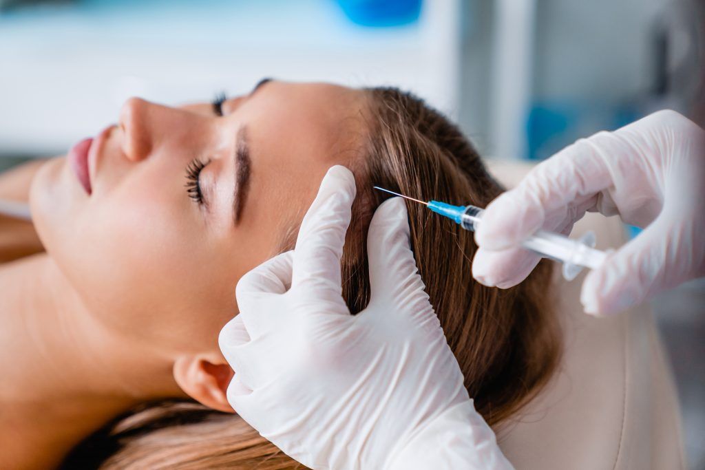 Mesoterapia capilar
