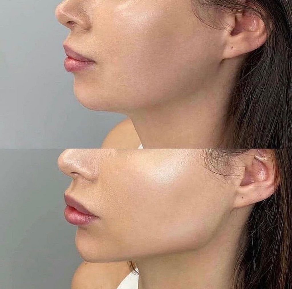 Russian Contouring