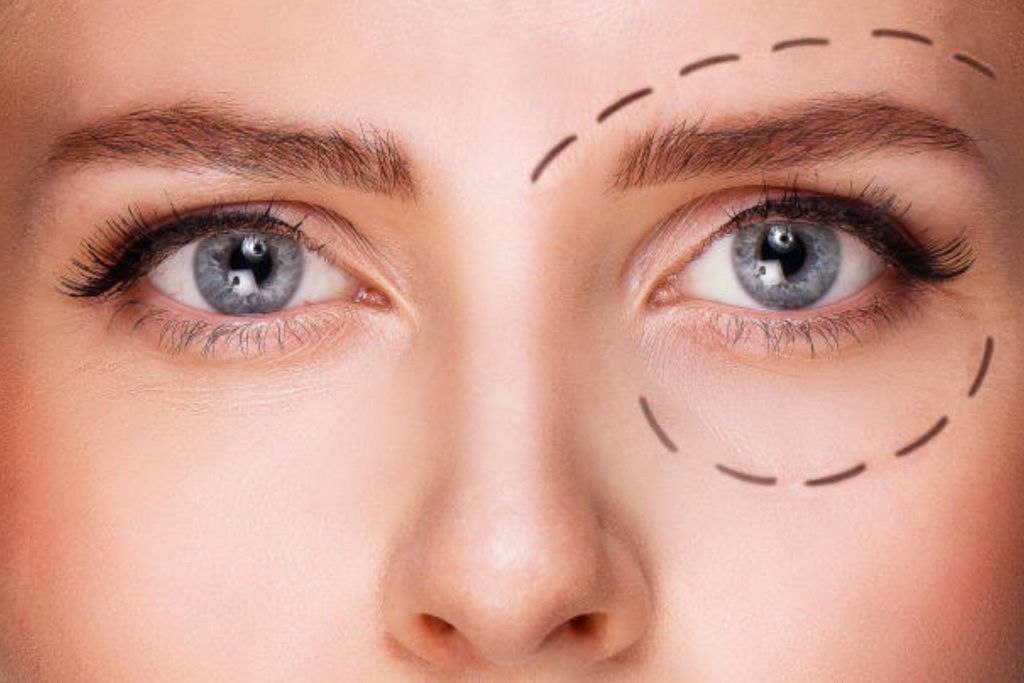 Bolsas y Ojeras