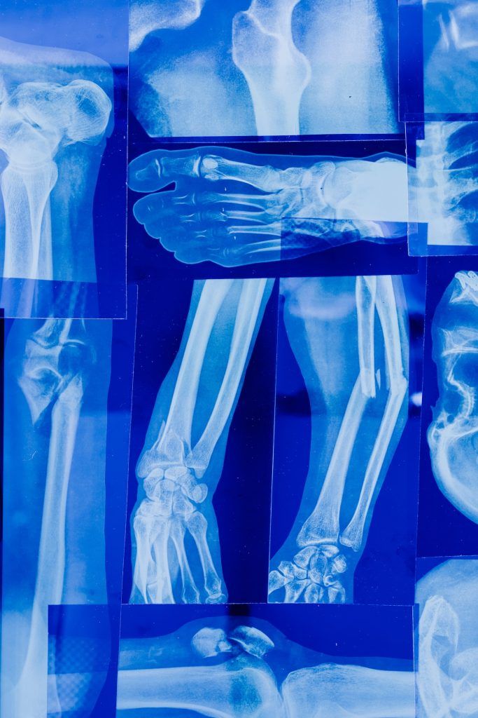 problemas osteoarticulares