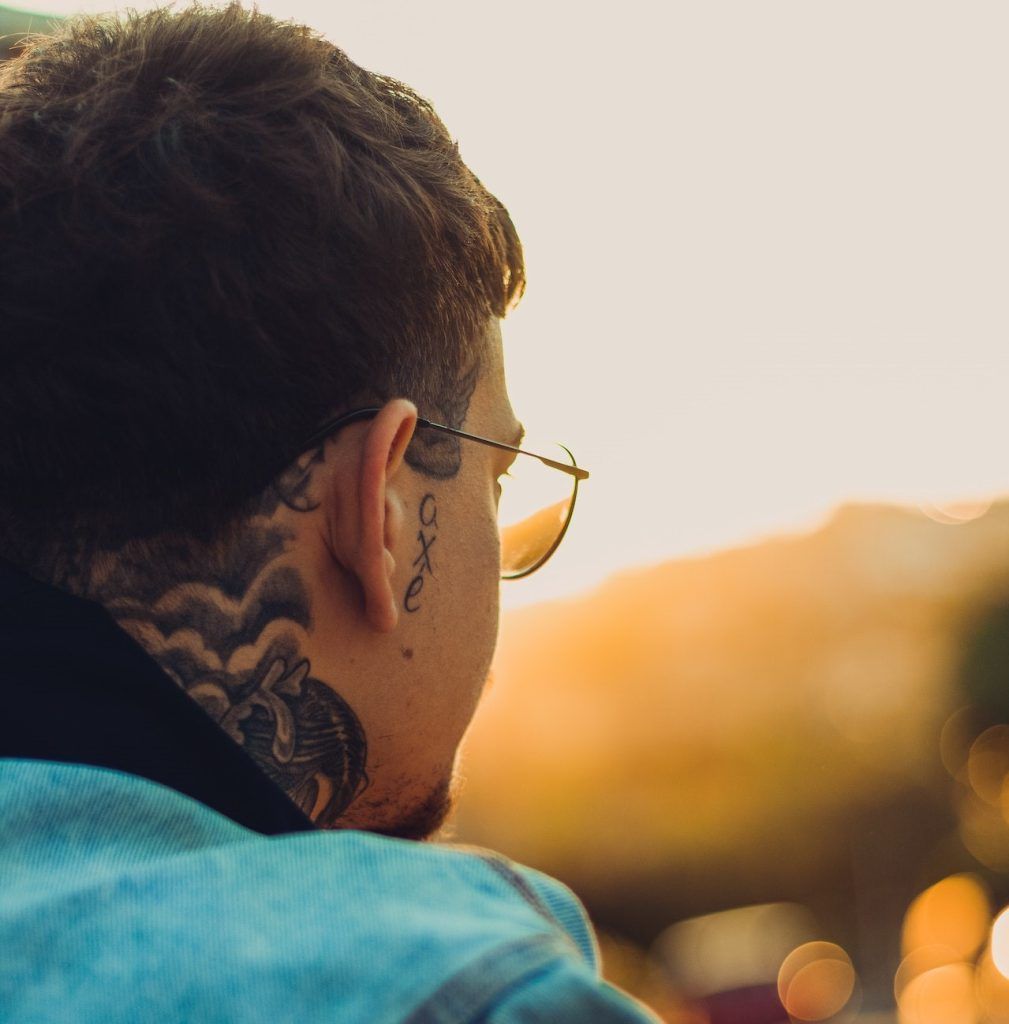 eliminación de tatuajes