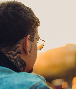 eliminación de tatuajes
