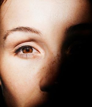 Ojeras