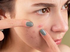 ¿Qué es la dermatilomanía? Dermatilomania