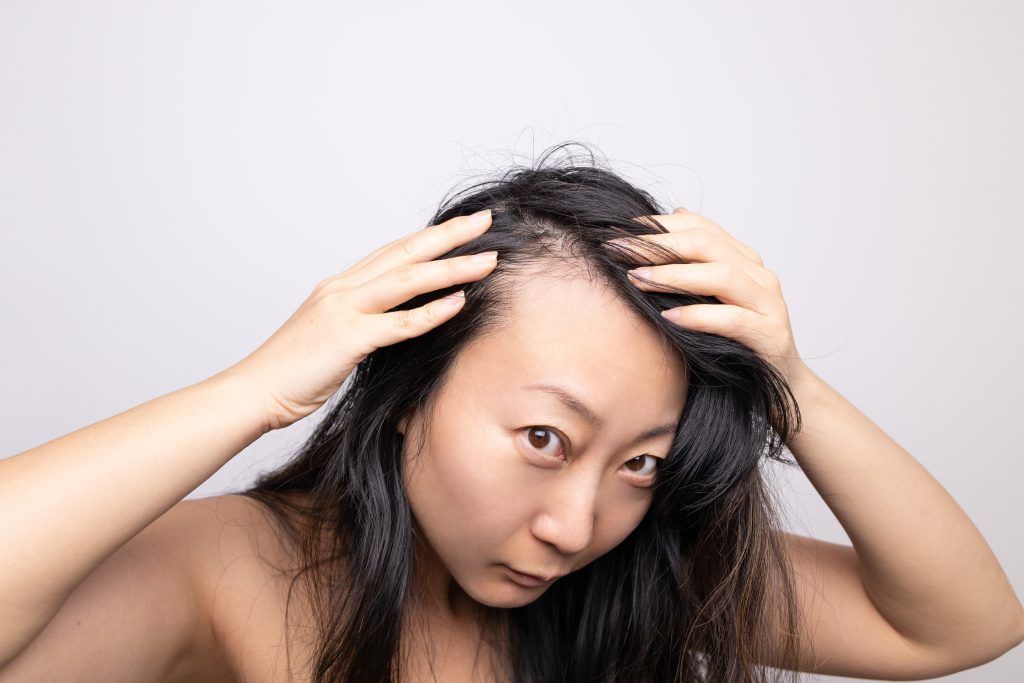 La Alopecia frontal fibrosante