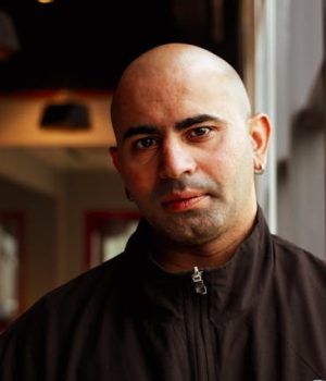 la alopecia androgénica la alopecia androgénica