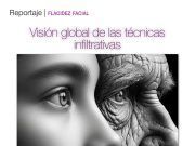 Flacidez facial. Visión global de las técnicas infiltrativas