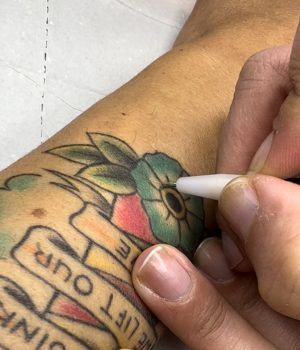 Electrodepilación tatuaje Electrodepilación tatuaje