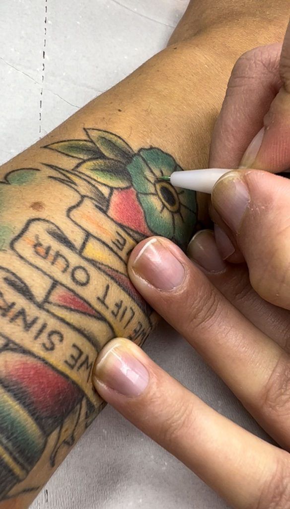Electrodepilación tatuaje