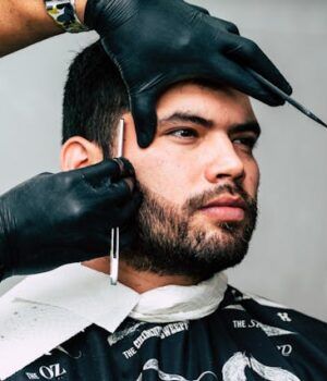 Injerto de barba