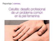 Celulitis: desafío profesional de un problema común en la piel femenina