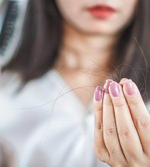 La caída del cabello