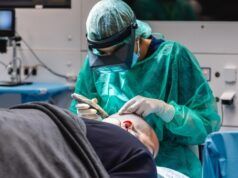 España lidera el mundo en alopecia y da un paso decisivo hacia la regulación del sector capilar alopecia