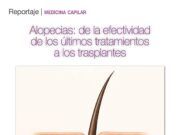 Alopecias: de la efectividad de los últimos tratamientos a los trasplantes