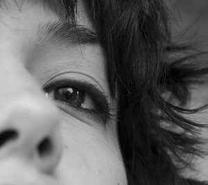 La oculoplastia