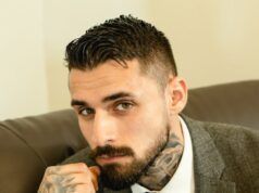 Lifting facial láser en clave masculina Lifting facial láser