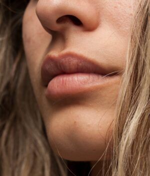 Labios