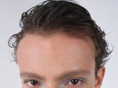 Fibrina para combatir la alopecia fibrina