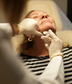 volumen facial
