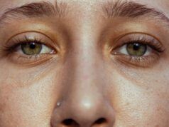 Ojeras: qué las producen y cómo tratarlas Ojeras