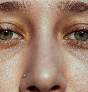 Ojeras Ojeras